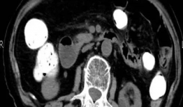 入腹视频,揭秘人体内部神秘世界